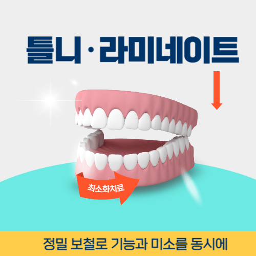 강릉치과 강릉시 치과 틀니 라미네이트