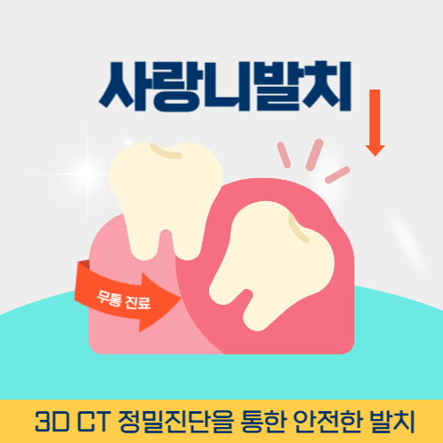 강릉치과 강릉시 치과 사랑니 발치